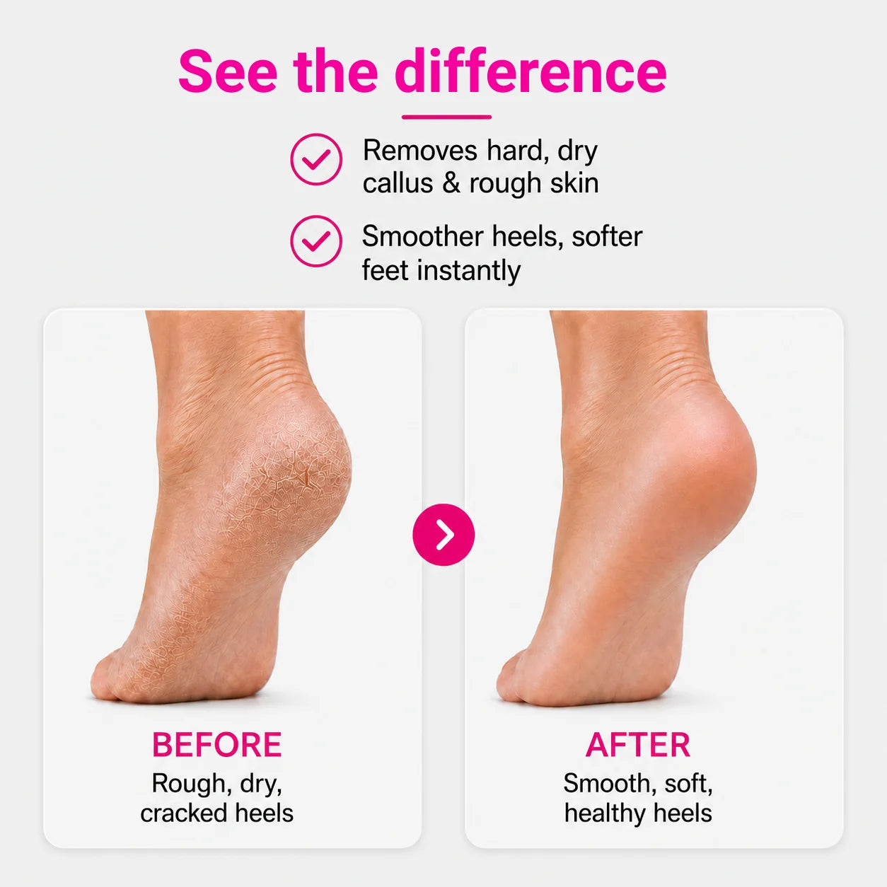 Electric Foot Callus Remover