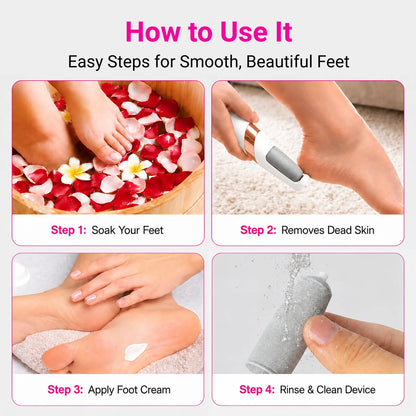 Electric Foot Callus Remover