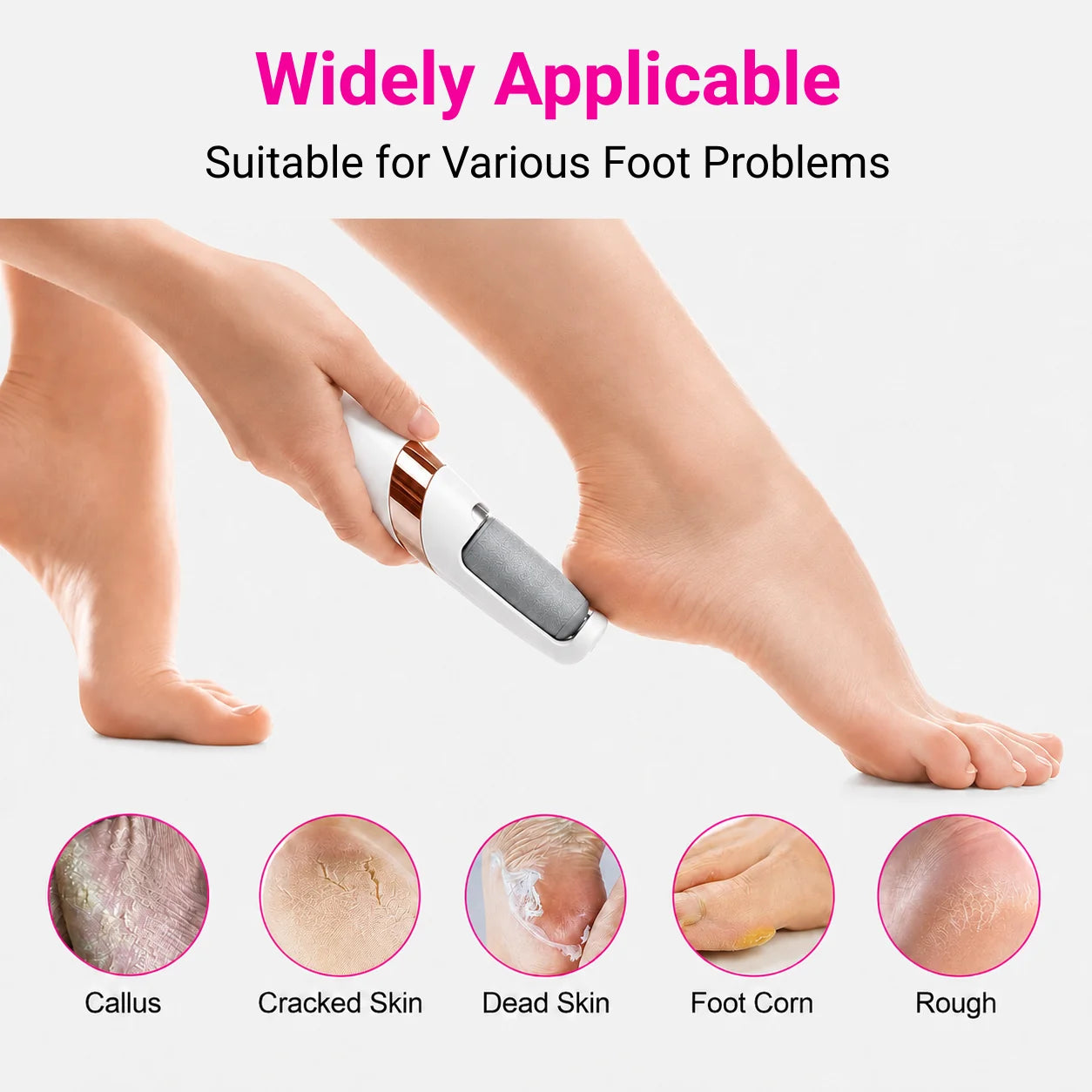 Electric Foot Callus Remover
