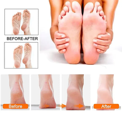 Professional Electric Foot Callus Remover Rechargeable Electronic Foot File Pedicure Tool Kit Foot Care for Dead Skin